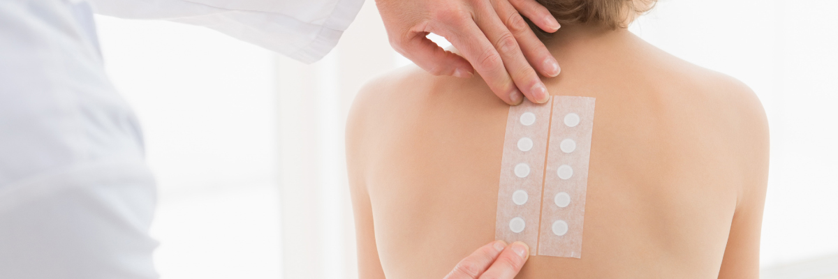 Exeter Skin Allergies & Skin Patch Testing by medical skincare consultants